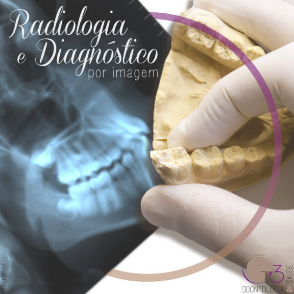 Radiologia e Diagnóstico por Imagem - Realização da radiografia no auxílio de diagnósticos - G3 Odontologia e Saúde